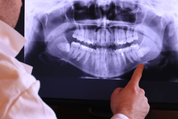 Best Cracked Tooth Emergency Dentist  in Prineville Lake Acres, OR