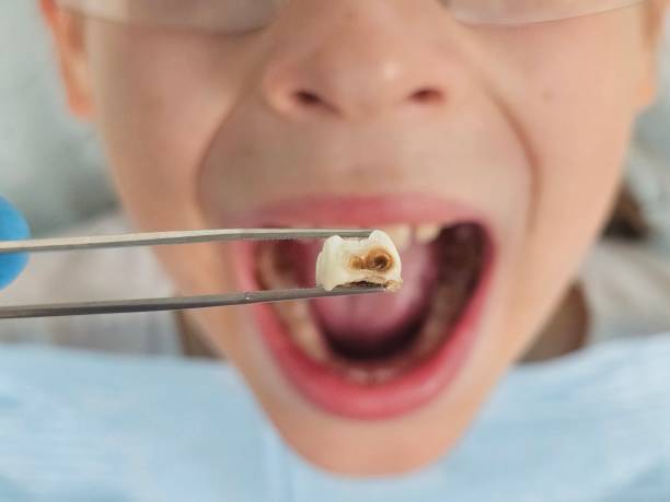 Emergency Dentist for Kids in OR