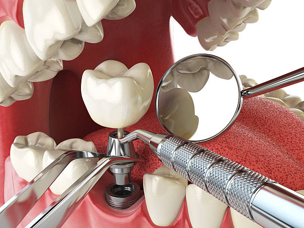 Best Urgent Tooth Repair  in Prineville Lake Acres, OR